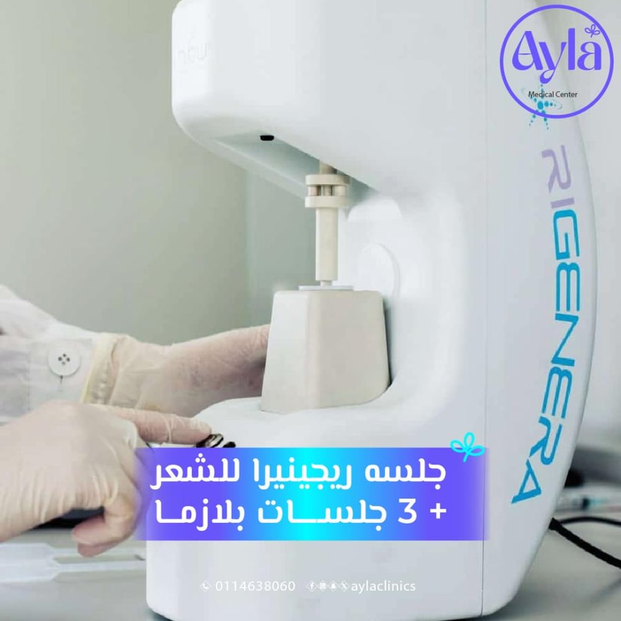 الريجنيرا  بديل زراعة الشعر  + 3 جلسات بلازما
