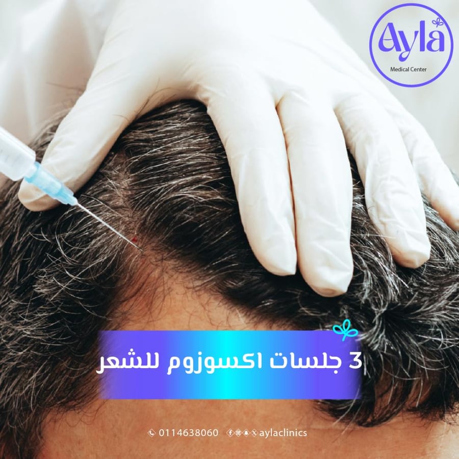 3 جلسات الاكسوزوم للشعر
