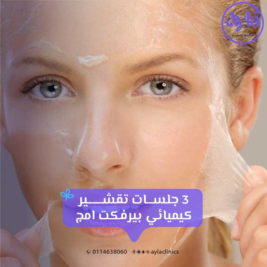 3 chemical peel sessions Perfect Image