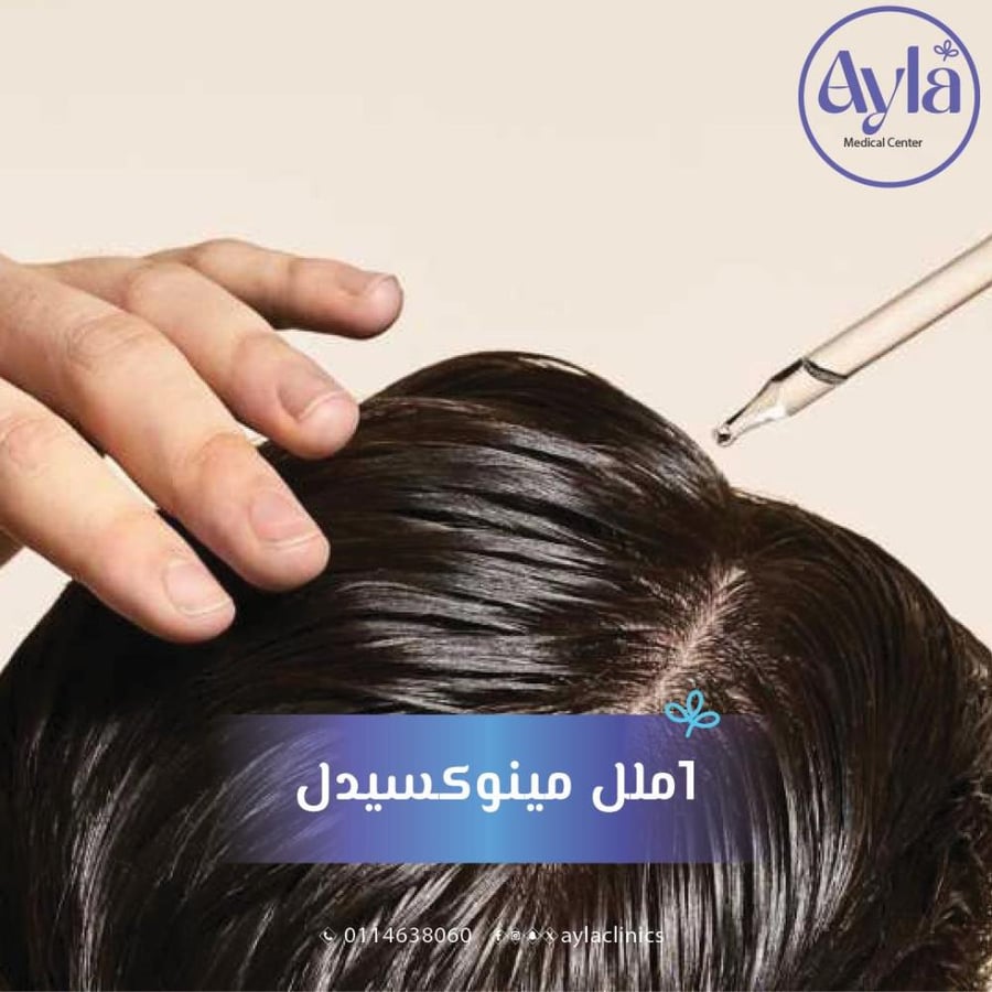 Minoxidil 1 ml