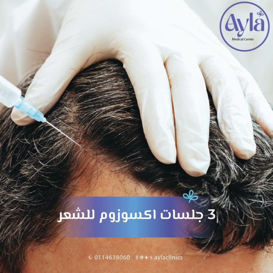 3 جلسات الاكسوزوم للشعر