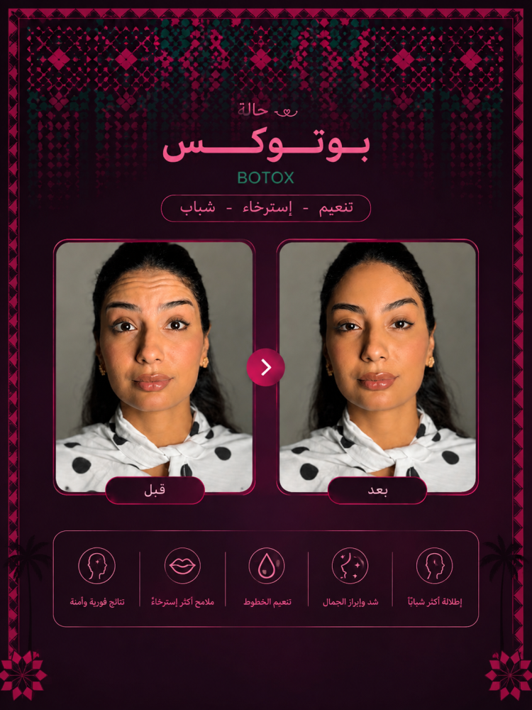 1مل فيلر + 1مل بوتكس