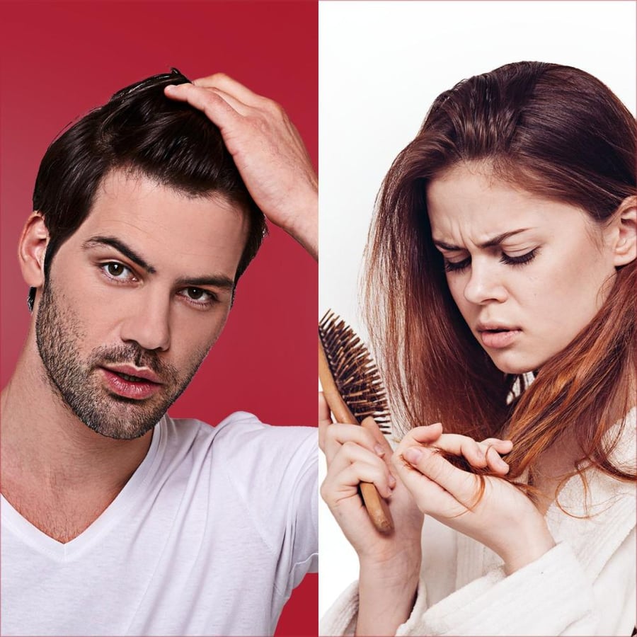 Aflon, Afogen 2%, spray solution, stimulates hair growth and prevents hair loss - 50 ml