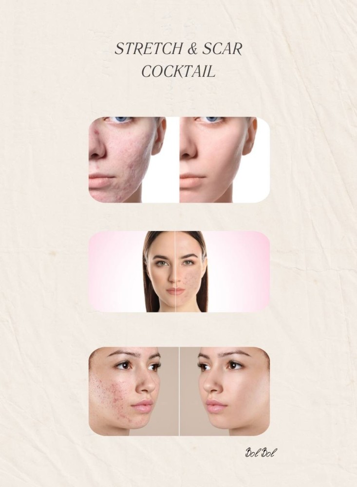 Mesotherapy Stretch & Scar Cocktail