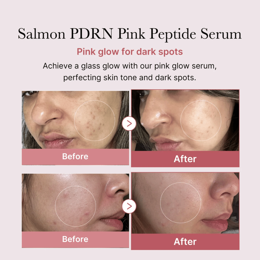 Pink peptide serum from the Mediheal brand - 30 ml