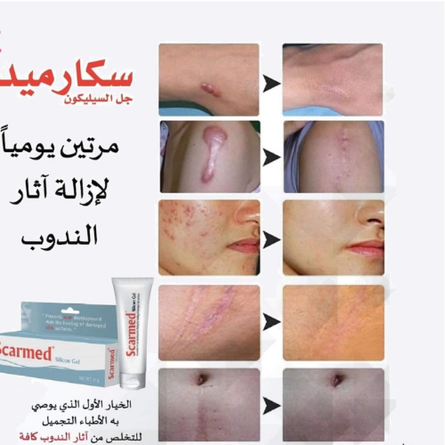 جل سيليكون من سكارمد 15جرام
