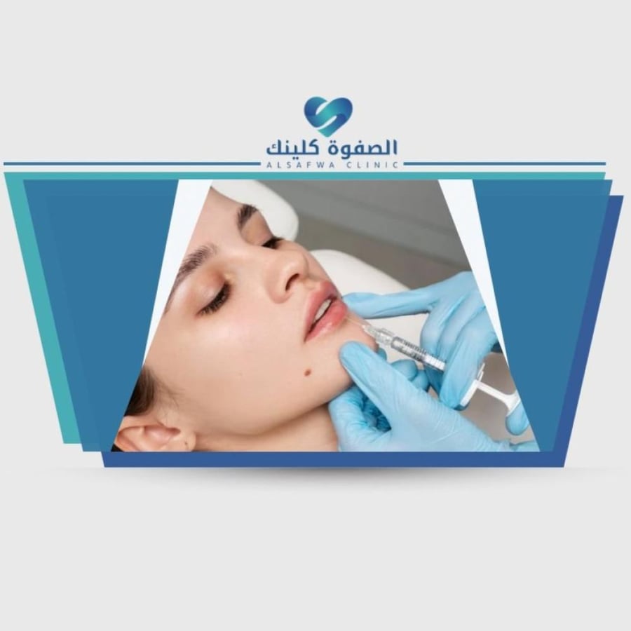 Full face Botox