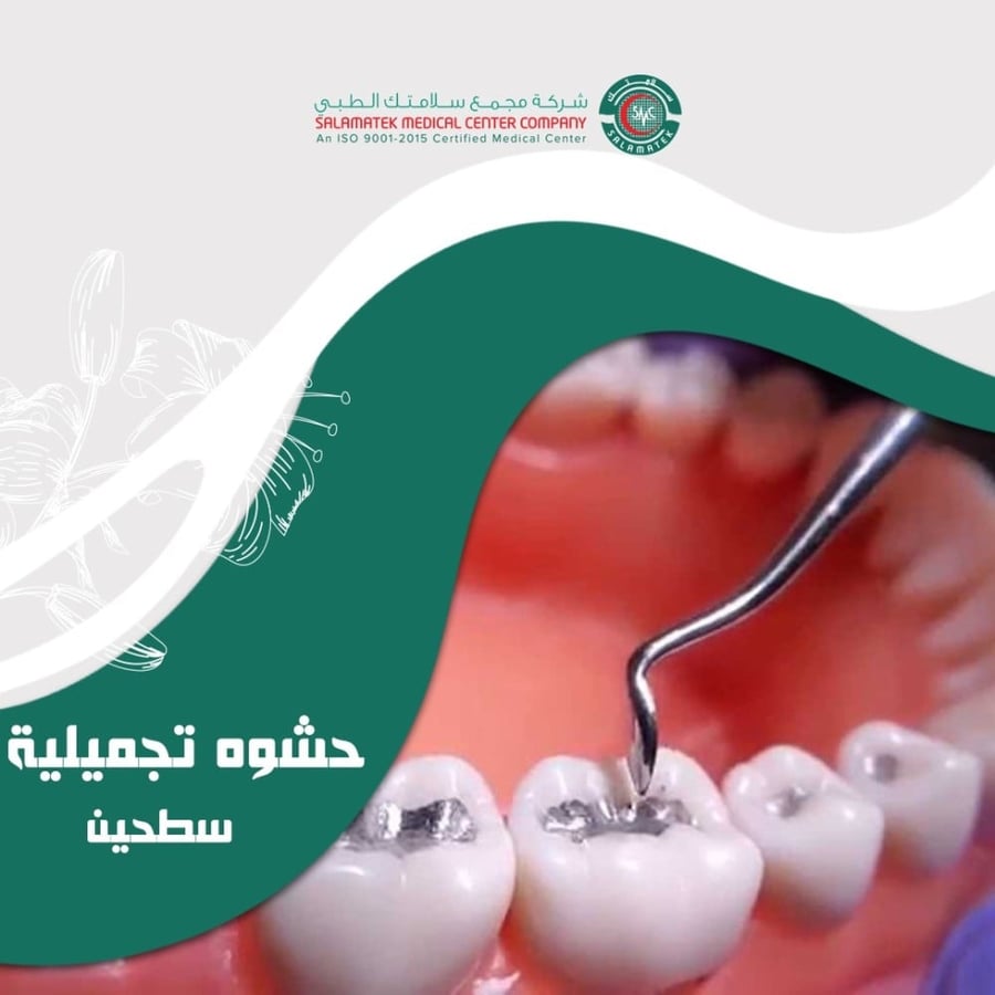 حشوة تجميلية سطحين (2129)