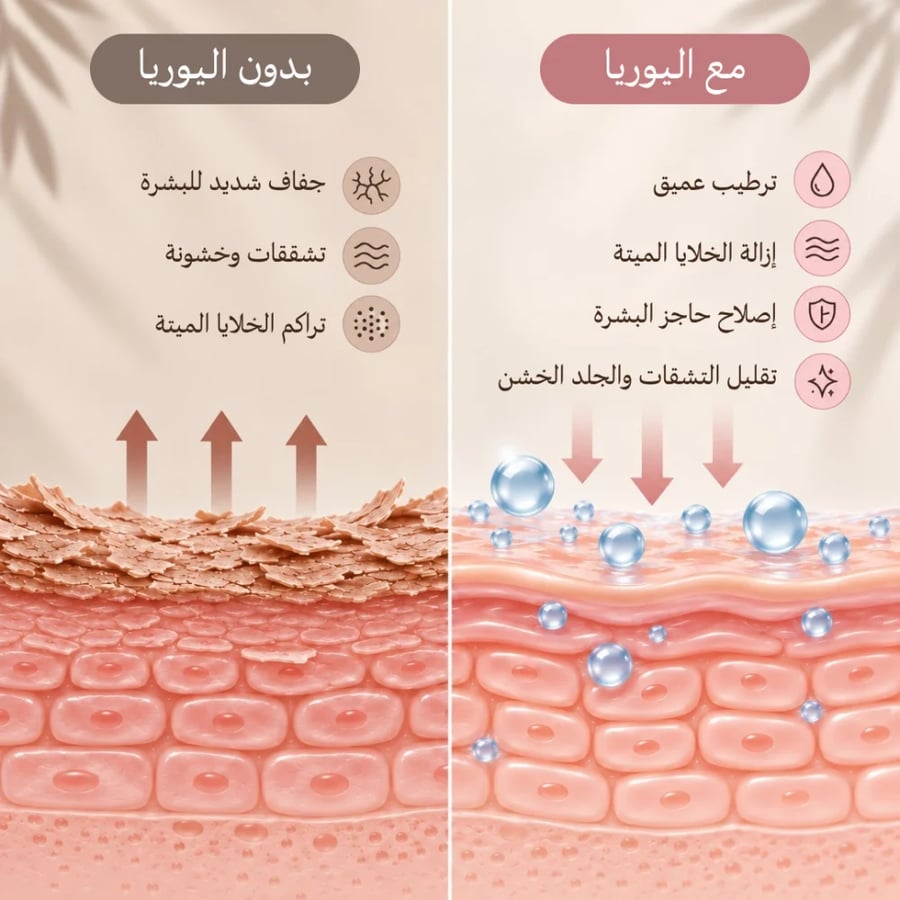 كريم يوريا بيرلانت للمناطق الخشنة وجلد الدجاجة | Pearlant Urea Cream 150g