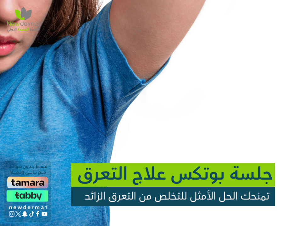 جلسة بوتكس لعلاج التعرق تحت الإبطين أو اليدين أو القدمين