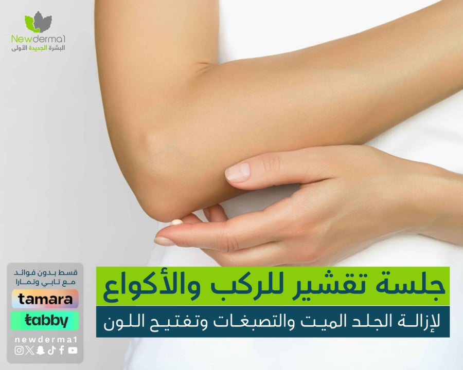 جلسة تقشير الركب والأكواع مع جلسة ليزر الإبط لتفتيح البشرة وإزالة الشع
