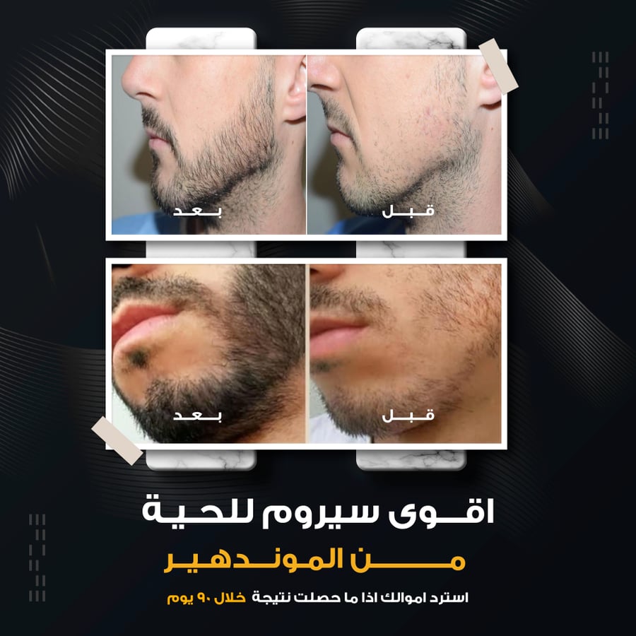 Almond Hair Power 7 in 1 Beard Oil for Maximum Protection and Growth