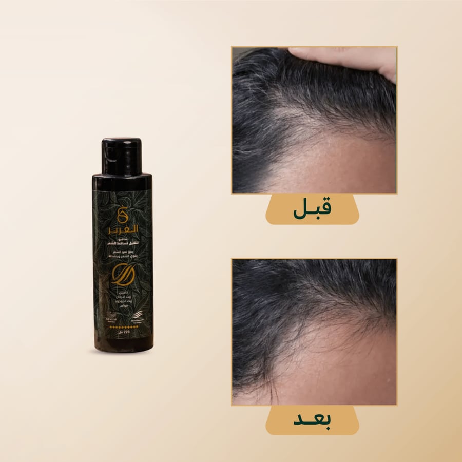 شامبو الغَرير الطبيعي لتقوية وتكثيف الشعر