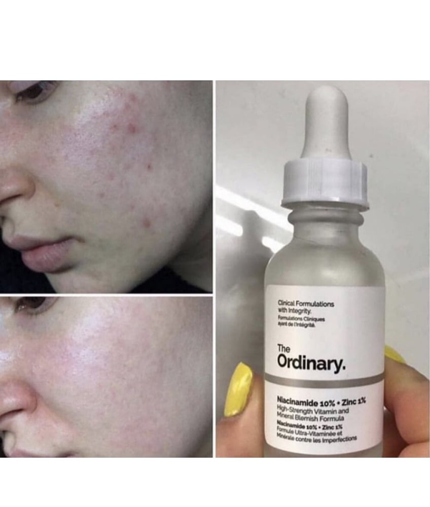 سيروم مكافح التصبغات ٦٠مل  | the ordinary  niacinamide 10 %  + zinc 1% 60ml