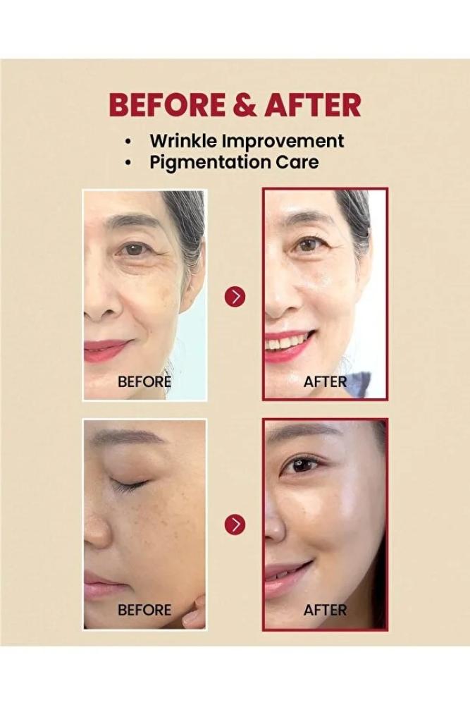 Serum سيروم ريتينال ليبوسوم 2% مع الجينسنغ الأسود 30 مل – سيول 1988 من كيه سيكريت