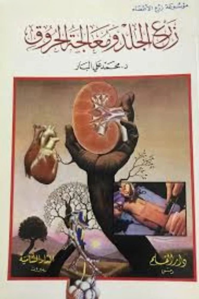 زرع الجلد وعلاج الحروق