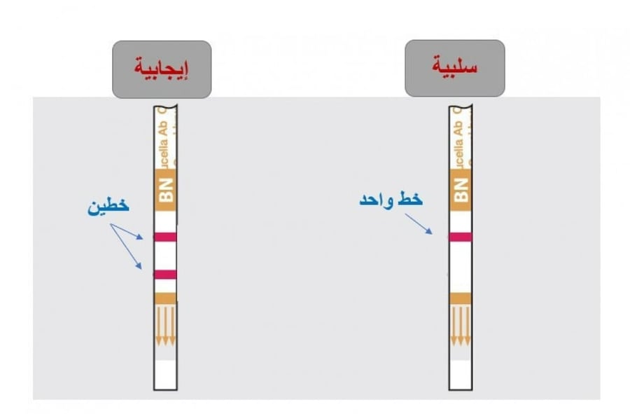 الفحص السريع الحمى المالطية في الإبل
