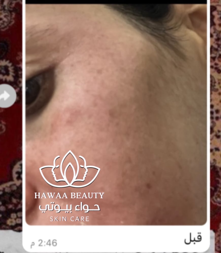 كريم الكلف كريم التصبغات تبييض تفتيح حواء بيوتي. صابونيه سنووايت