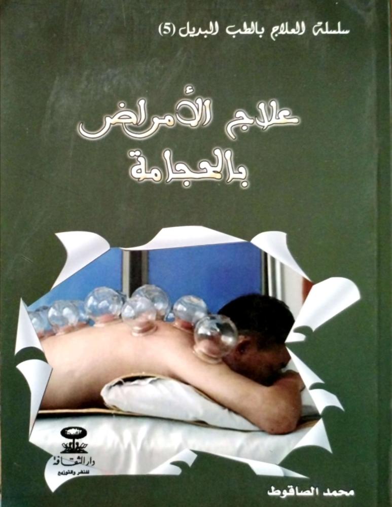 علاج الأمراض بالحجامة