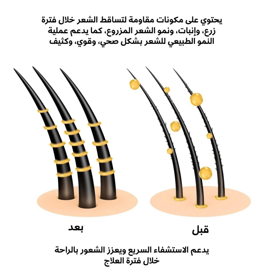 مصل