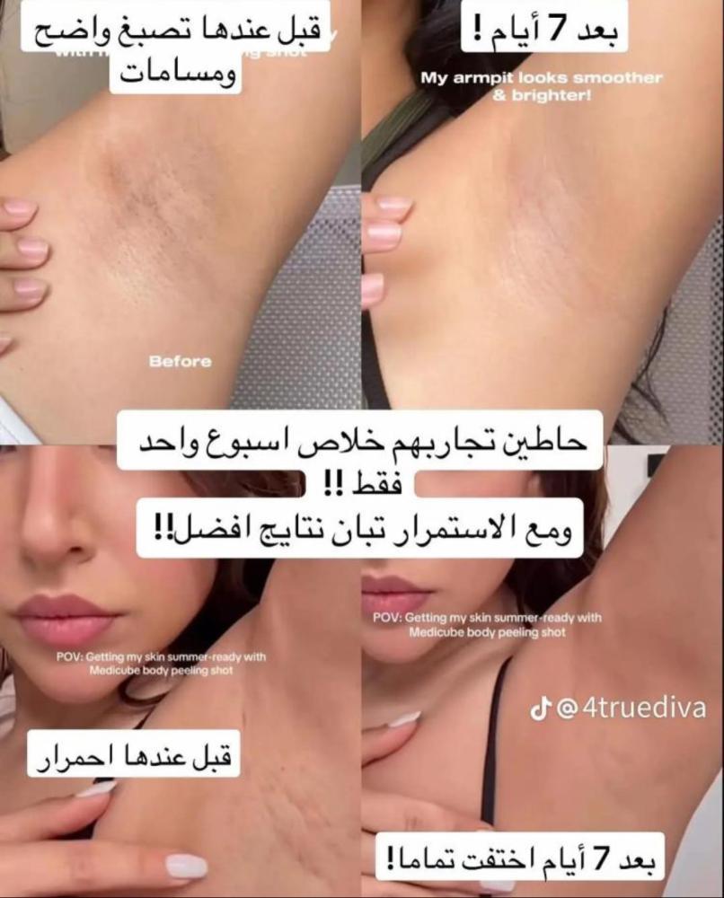 ثلاثي القضاء على الحبوب من ميديكيوب