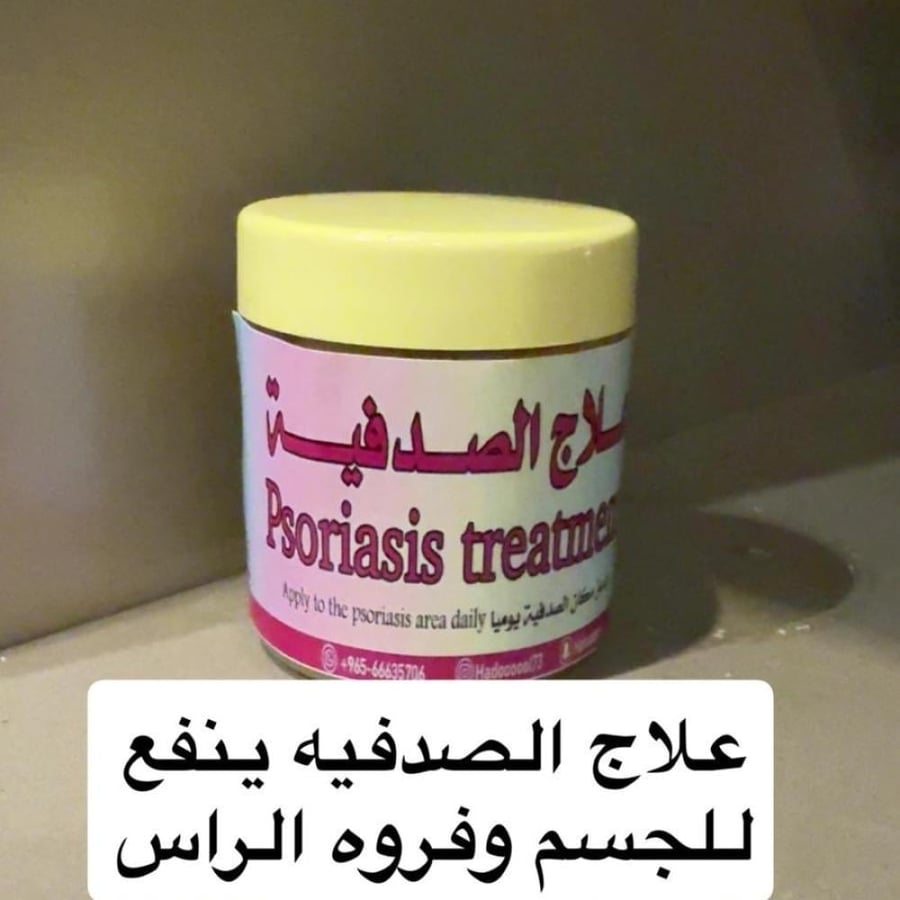 علاج الصدفيه
