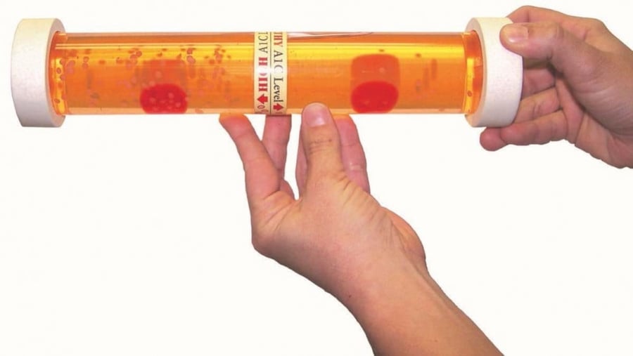 A1c Levels An Inside Look Model