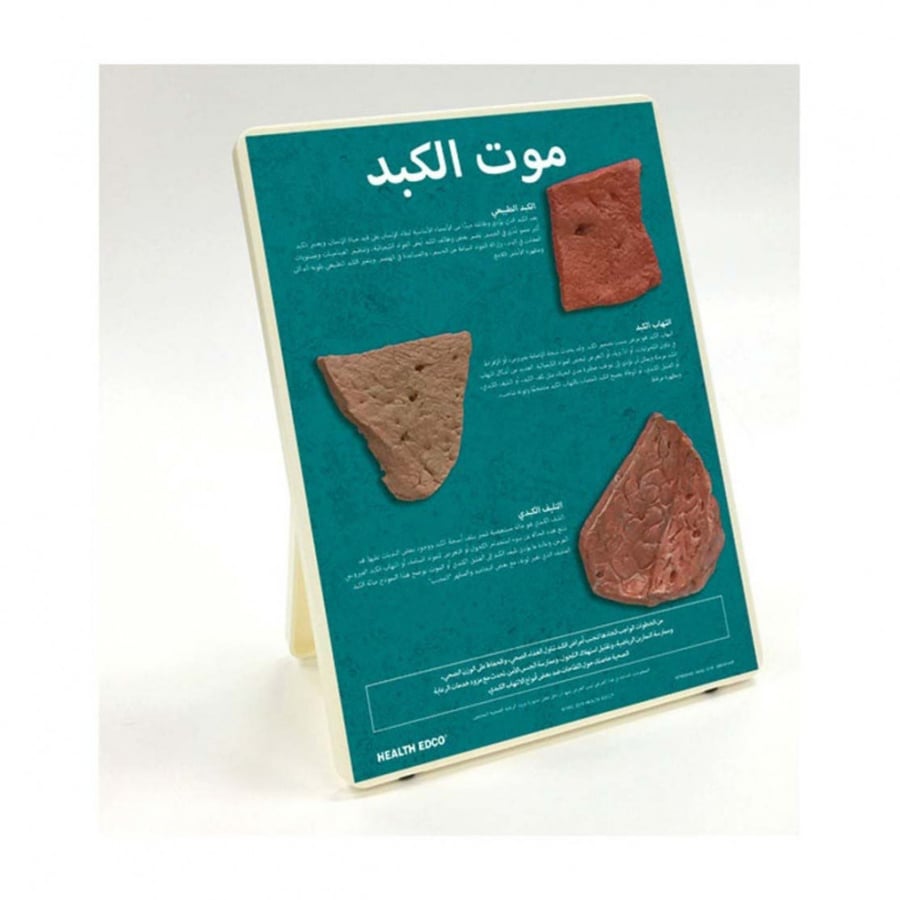 Death Of A Liver Easel Display (ARABIC)