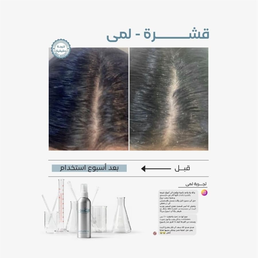 محاسن زيت الشعر كثافة و تحفيز و نمو الشعر وإطالته