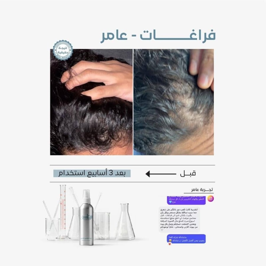 محاسن زيت الشعر كثافة و تحفيز و نمو الشعر وإطالته