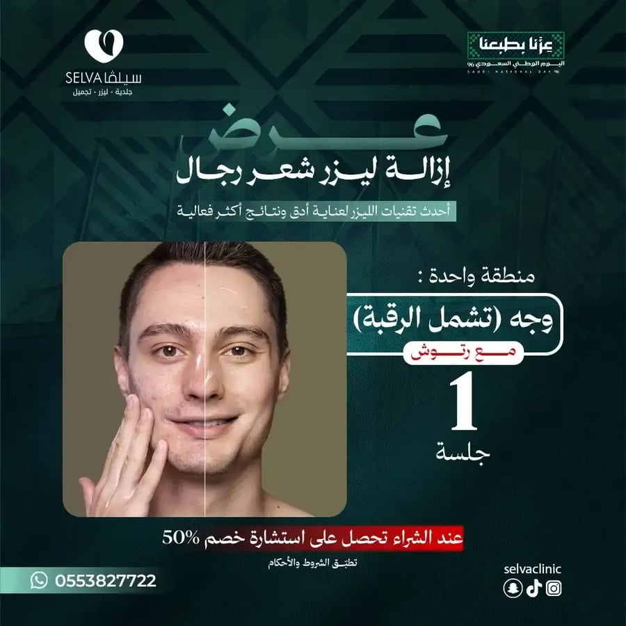 جلسة إزالة ليزر شعر منطقة الوجه تشمل الرقبة + مع رتوش (رجال) (عرض) **لا يوجد استرجاع أو استبدال**