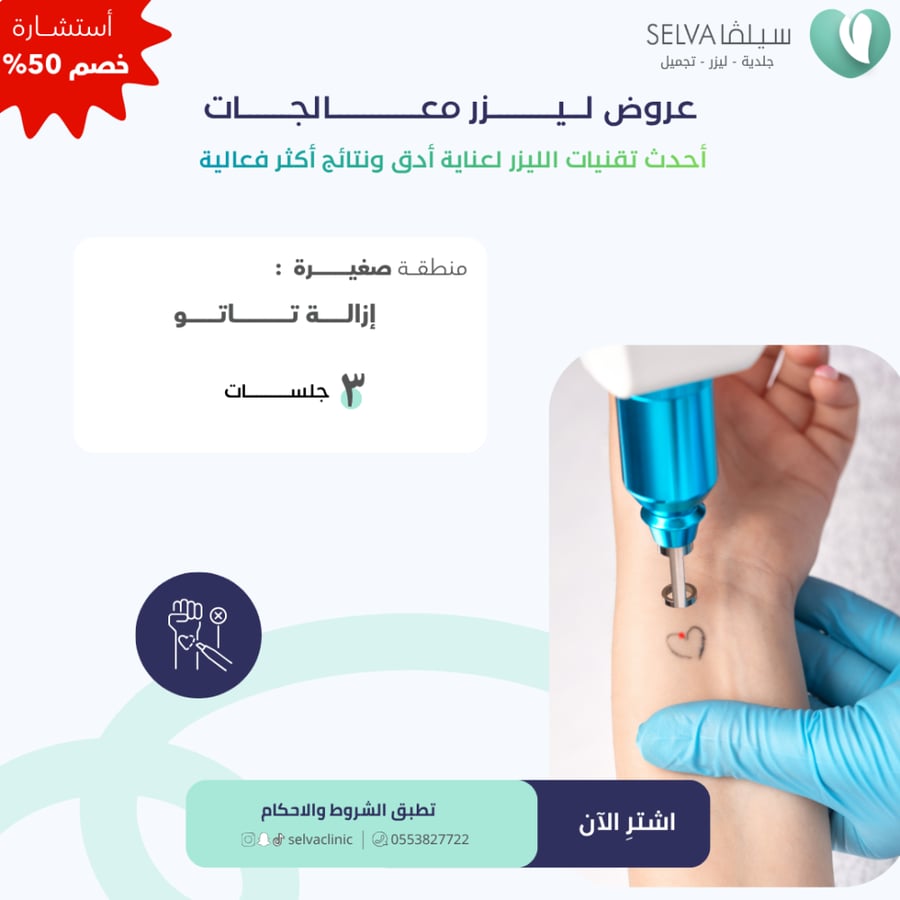 3 جلسات ازاله تاتو منطقة صغيره (عرض)  **لا يوجد استرجاع أو استبدال**