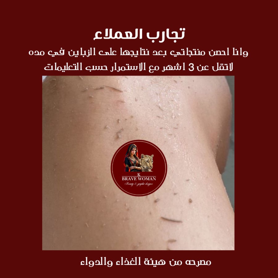 مجموعة التبييض