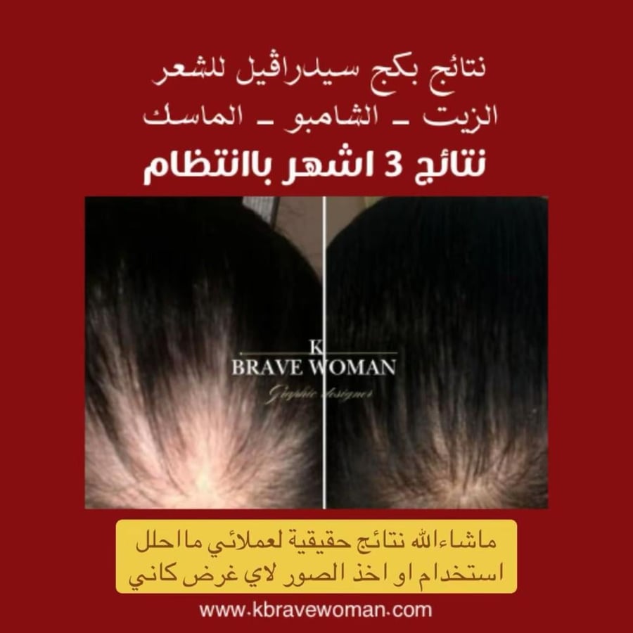 بكج سيدرا ڤيل