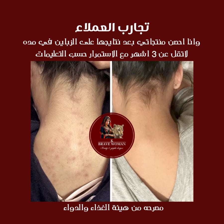 مجموعة التبييض