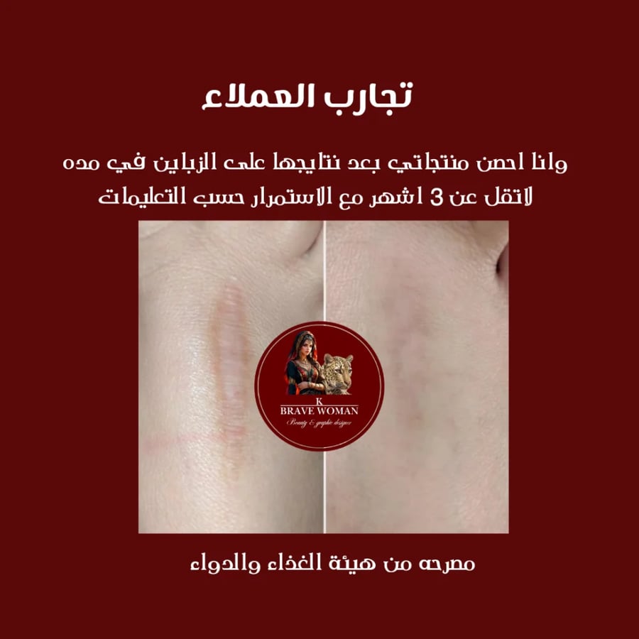 مقشر للجسم