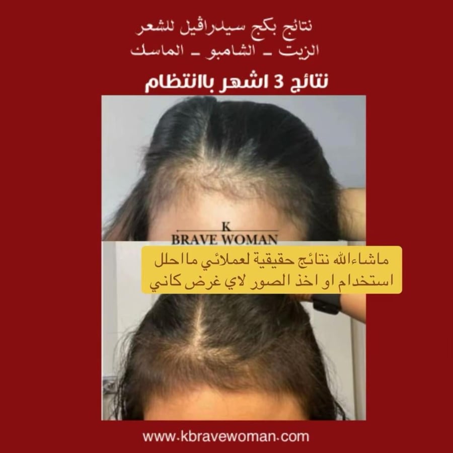 بكج سيدرا ڤيل