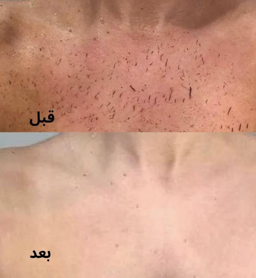 ليفة My Skin 2 الحريرية - تقشير قوي وفعال