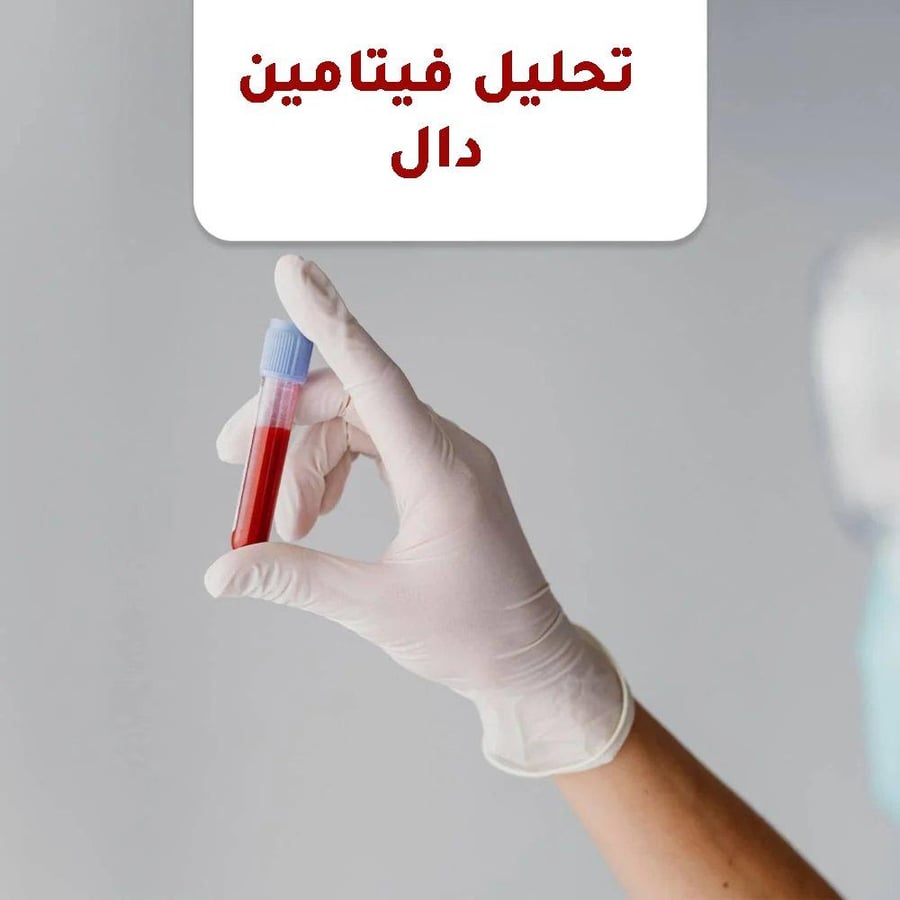 تحليل فيتامين دال