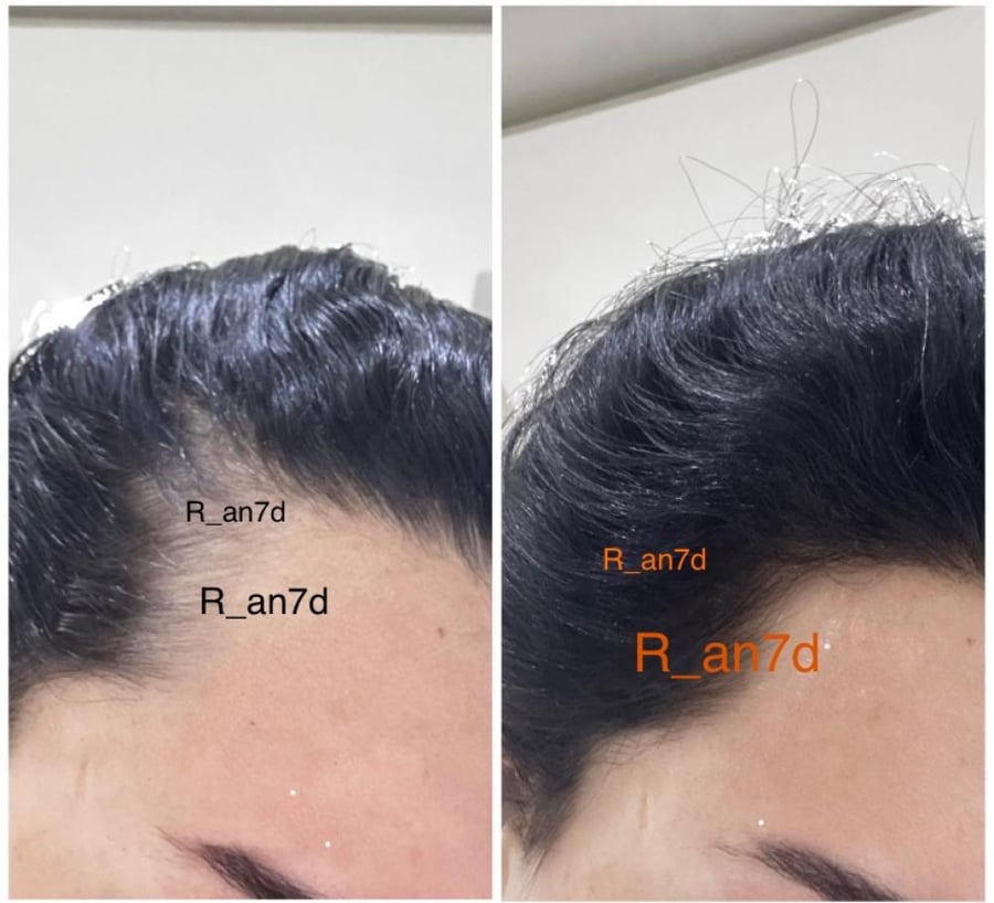 زيت المعجزة للشعر R&M