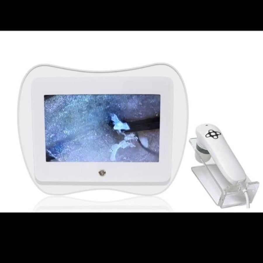 جهاز فحص فروة الرأس Scalp Analyzer Machine