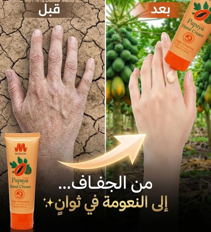 كريم اليدين بالبابايا المطور لتفتيح البشرة من مورفون
