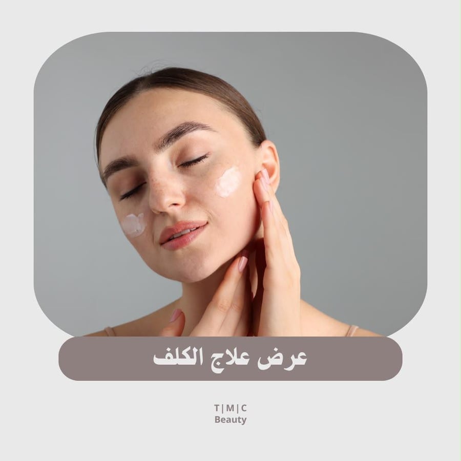 علاج الكلف