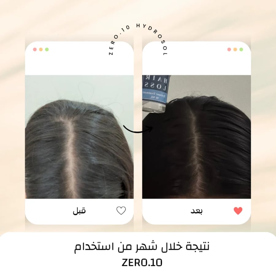 ZERO.10 نتيجة شهر لتقليل اتساع فرق الشعر