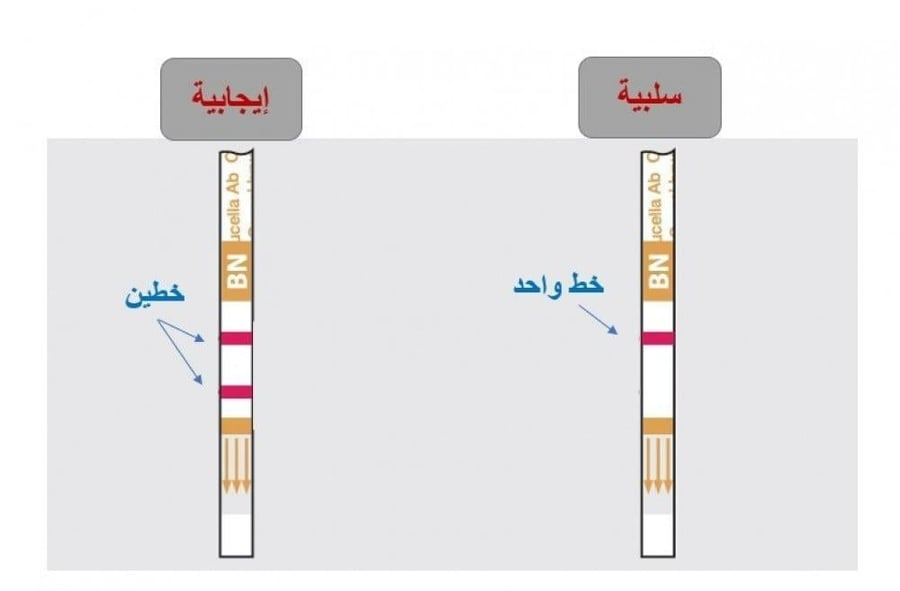 شرائح فحص المالطية للإبل – كرتون 10 فحوصات