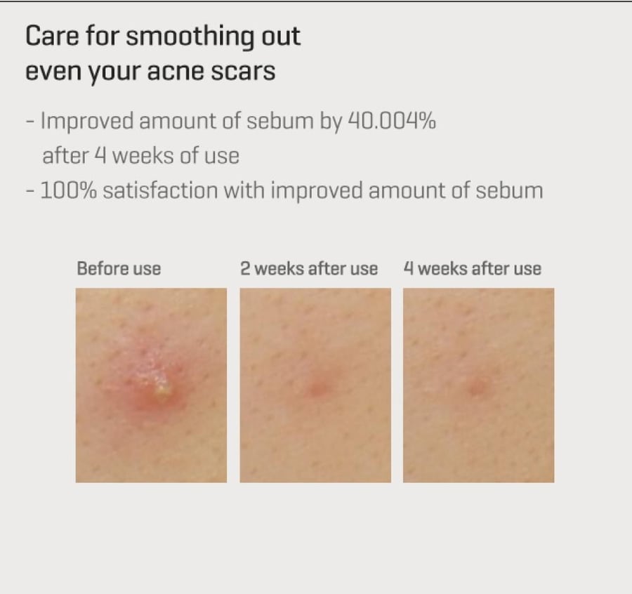 سيروم ريتينول للعناية المركزة – Some By Mi – 30 ML