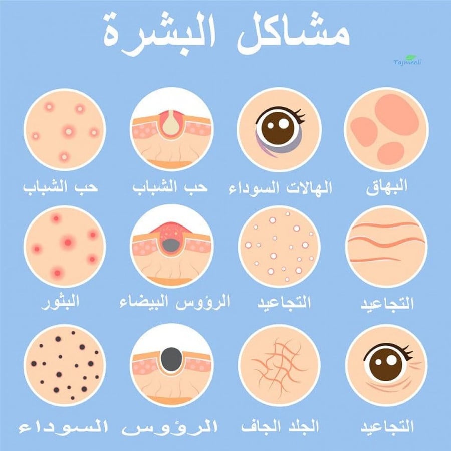 كريم لتفتيح الأماكن الداكنة بالجسم بيجما نورم 30 جم