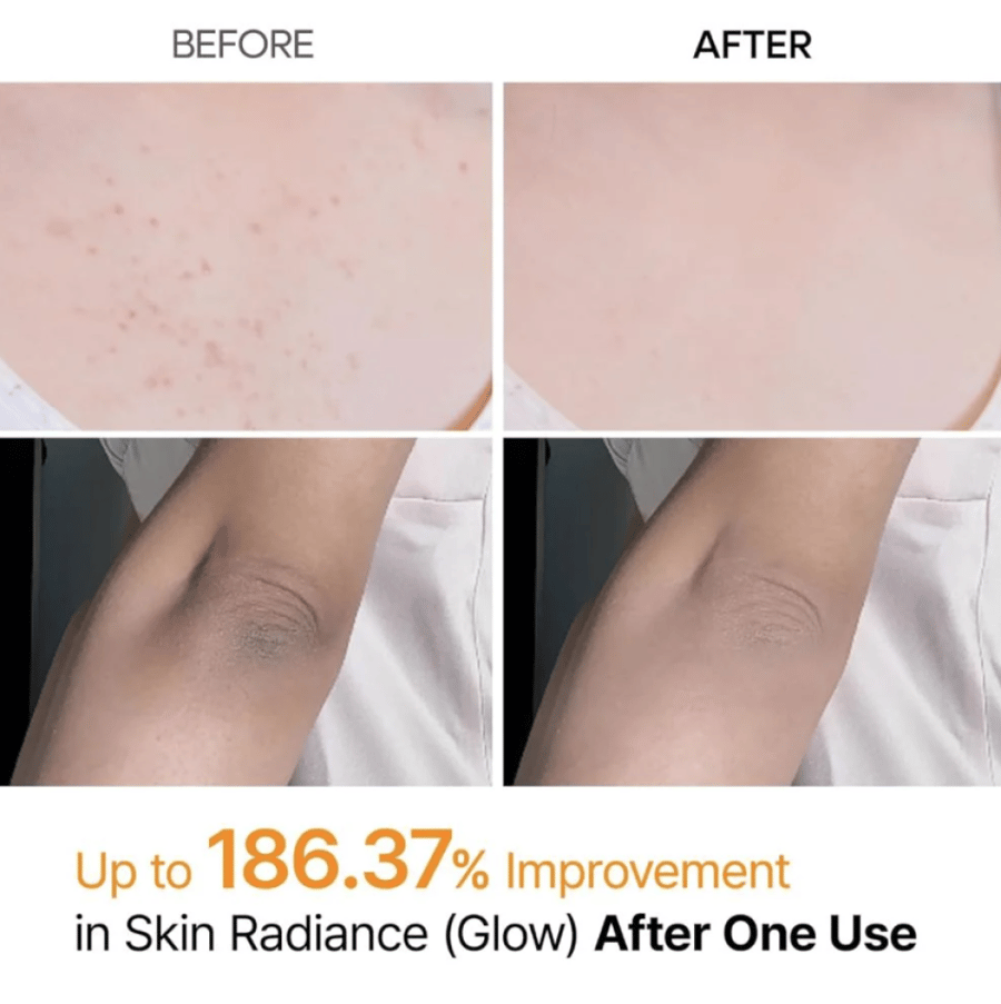 Bill Shot exfoliating spray with kojic acid and turmeric from Dr. Melaxine - 200 ml