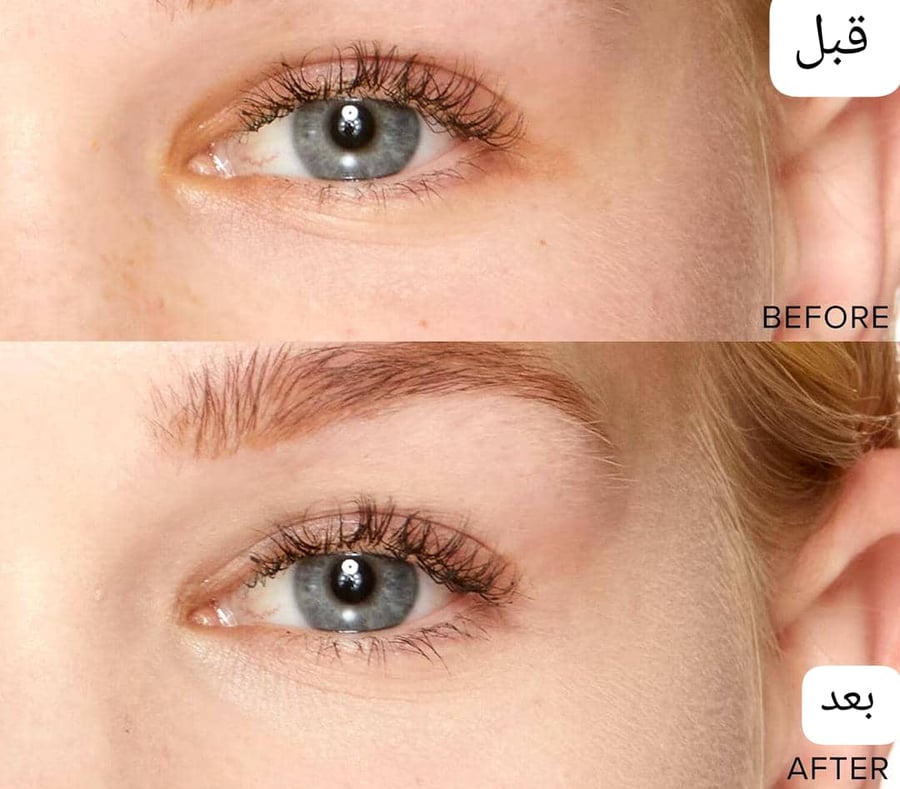 بورن ذيس واي كونيلسر ذات-متجر-joelle