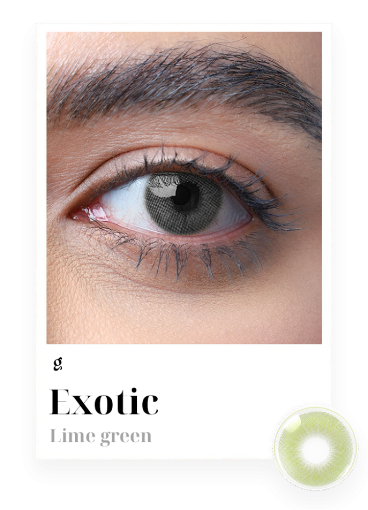 إكزوتك Exotic